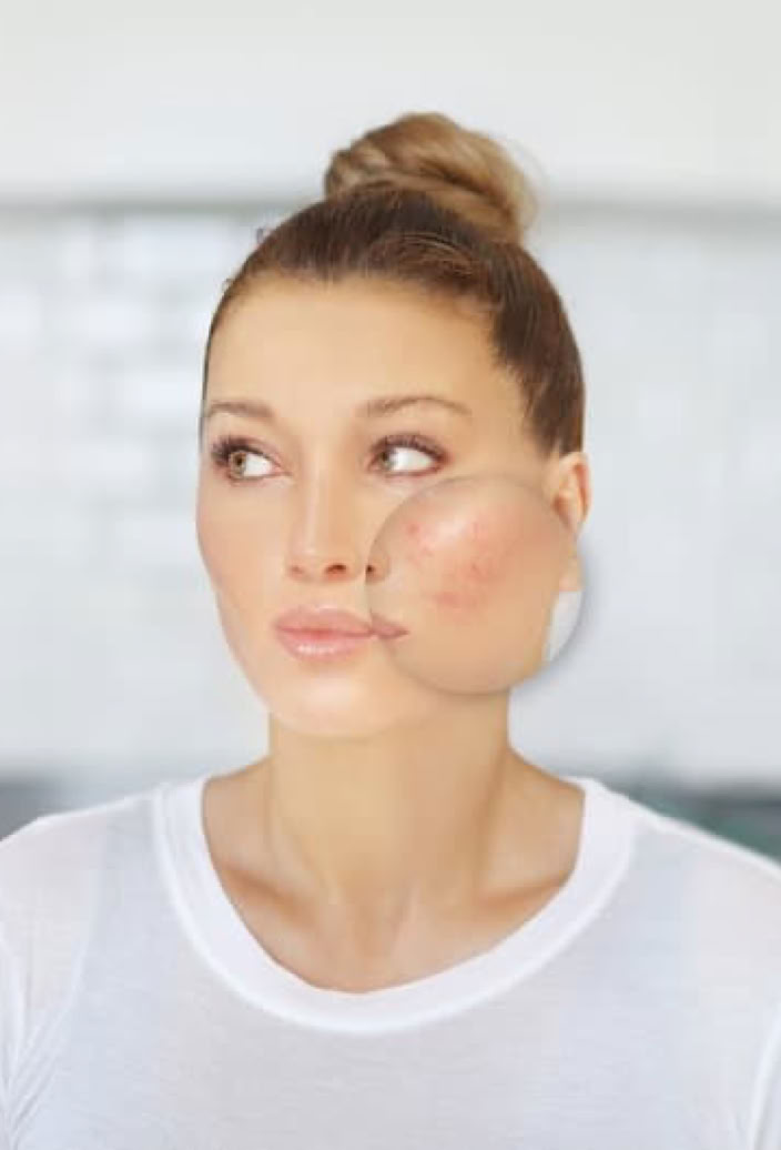 Experience the Sensitive Skin Calming Facial by Ana Tagliaferro, a restorative treatment designed to soothe redness, reduce irritation, strengthen the skin barrier, and promote lasting comfort. Ideal for sensitive, reactive, and stressed skin in Coral Gables, Miami.