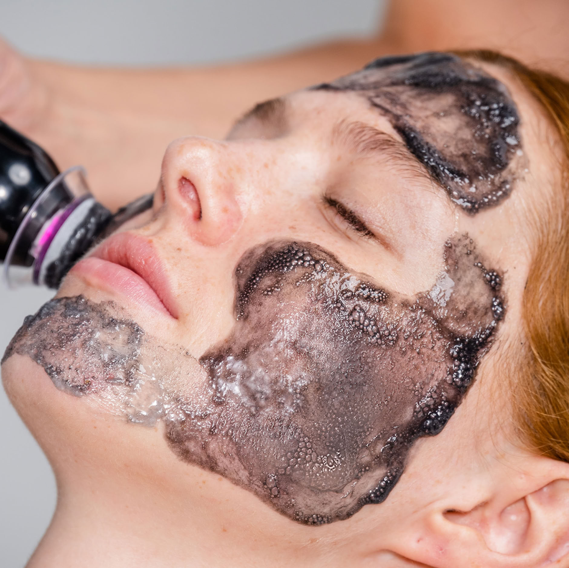 Oxygenating facial treatment combining exfoliation, infusion and revitalization for healthier-looking skin.