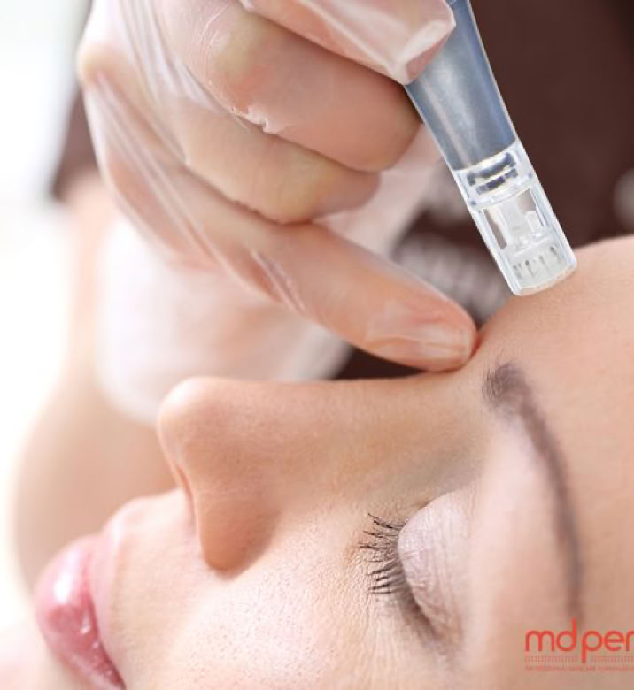 Experience MDPen® Collagen Induction Therapy with Ana Tagliaferro, an advanced microneedling treatment designed to stimulate collagen production, improve skin texture, soften scars, refine pores, and support firmer, healthier-looking skin in Coral Gables, Miami.